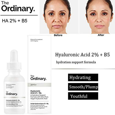 The Ordinary Hyaluronic Acid 2% + B5 30ml - Mirela Mendoza